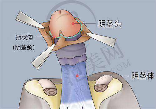 厦门薇格整形美容医院怎么样，口碑评价如何？