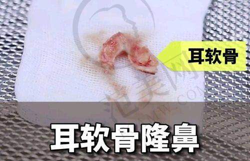 菏泽华美整形医院医生简介
