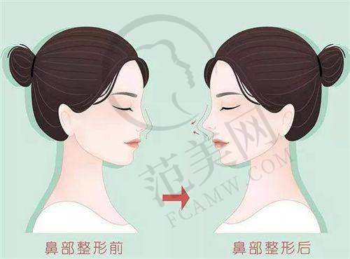 上海爰美仕医疗美容门诊部怎么样，口碑评价如何