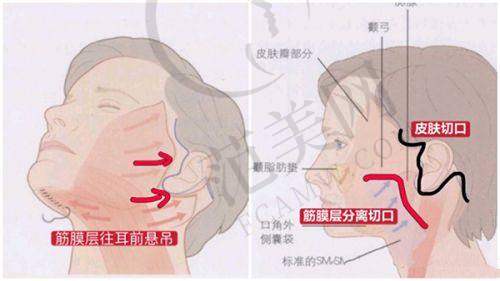 合肥凯婷医疗美容门诊部地址及乘车路线