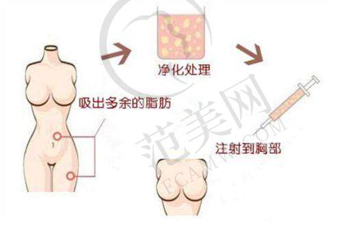 厦门薇格整形美容医院价格表