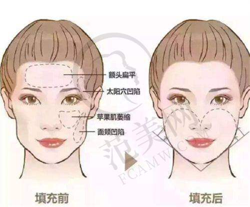 西安思悦医疗美容门诊部项目特色