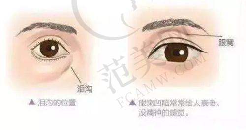 七、中山市人民医院光子嫩肤成效反馈参考：术中与术后短期的成效呈现