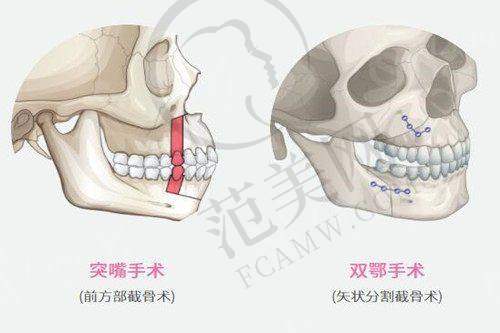 汕头华美医疗美容医院地址及乘车路线