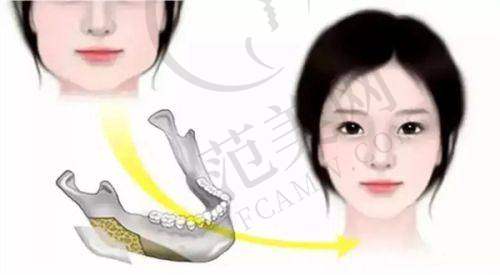 上海悦心医疗美容门诊部地址及乘车路线