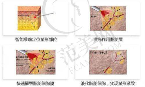 襄阳维多利亚整形医院怎么样，口碑评价如何？