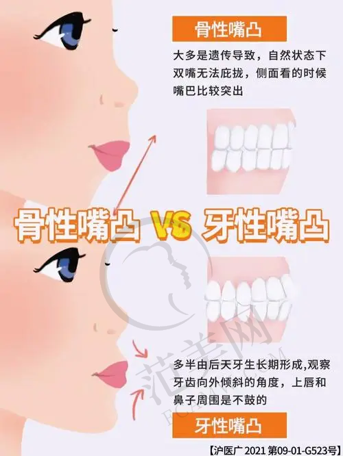 杭州艺星整形隆胸价格情况之一:基础隆胸手术价格