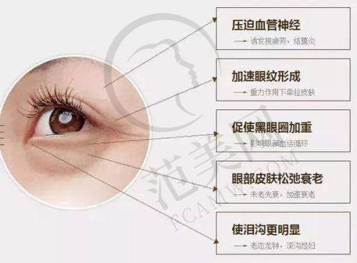 杭州艺星整形隆鼻价格情况之一:基础隆鼻手术价格
