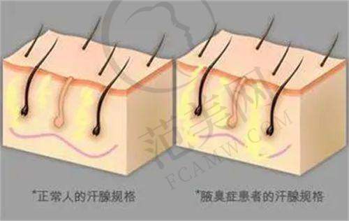 厦门薇格整形美容医院口碑好不好？附真实患者口碑评价