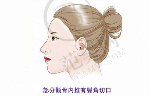 金华维多利亚美容医院项目特色