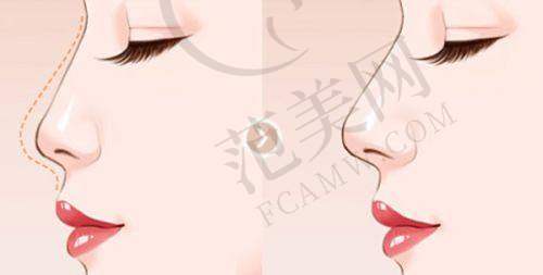 昆明维多利亚医疗美容医院口碑好不好？附真实患者口碑评价