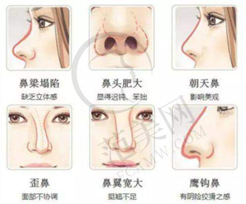 昆明维多利亚医疗美容医院怎么样，口碑评价如何？