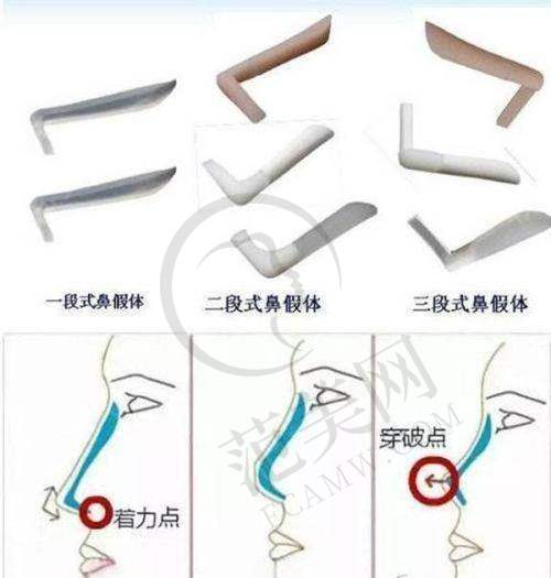 西安艺星医疗美容门诊部价格表