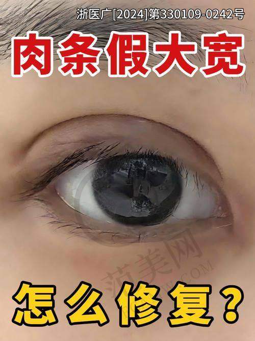 合肥伊尔切开双眼皮18000元起怎么预约