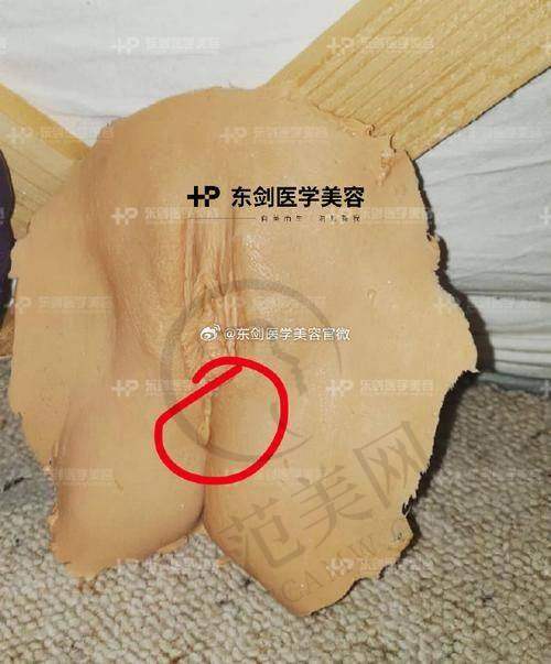 广州大阴唇整形十佳推荐——广州曙光医学美容医院