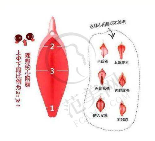 东莞埋线紧缩阴道榜单精选：东莞长安安美整形医院
