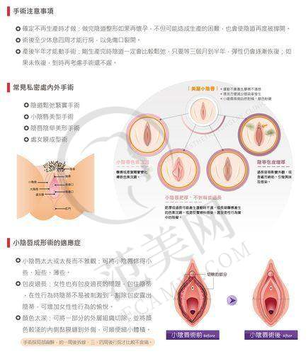 东莞埋线紧缩阴道榜单精选：东莞伊然整形医院