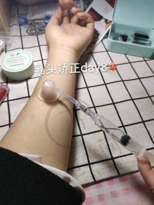 南京维多利亚整形美容乳头缩小10000元起项目简介