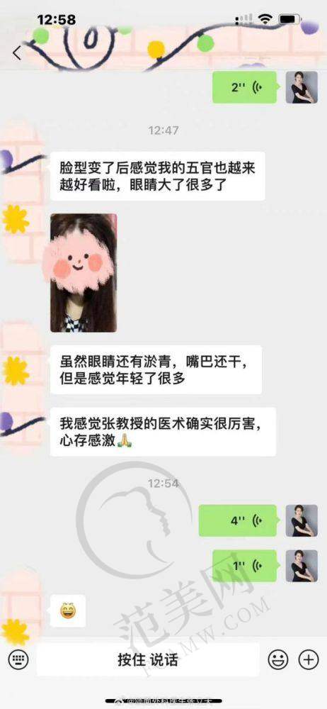 上海九院颧骨颧弓磨骨72000元起项目简介