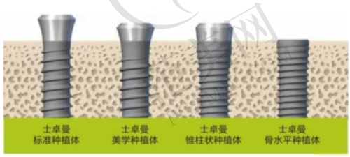 七、不同价格的种植牙适合哪些人群呢？