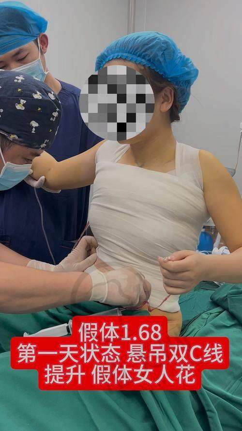 二、美波婷注射丰胸：“双胶原支架”技术的神奇之处