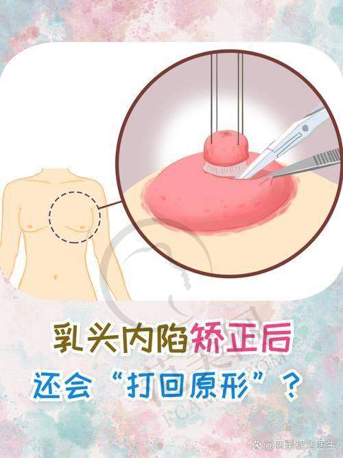 合肥翡奢乳晕缩小8000元起对患者生活的影响