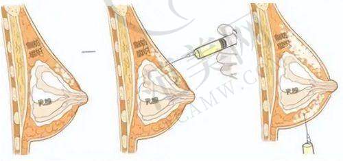 乌鲁木齐友谊医院整形科口碑好不好？附真实患者口碑评价