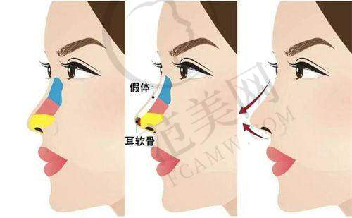 乌鲁木齐友谊医院整形科怎么样，口碑评价如何？