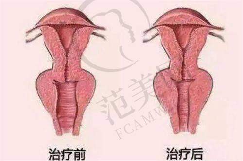 乌鲁木齐友谊医院整形科项目特色
