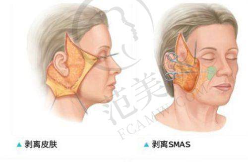 二、备受喜爱的广州私立整形医院壹加壹情况大揭秘