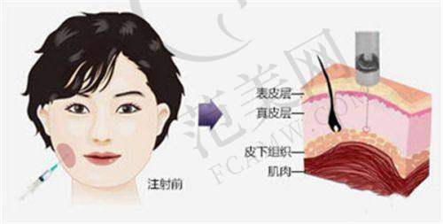 六、广州私立整形医院壹加壹医生技术优势在哪里