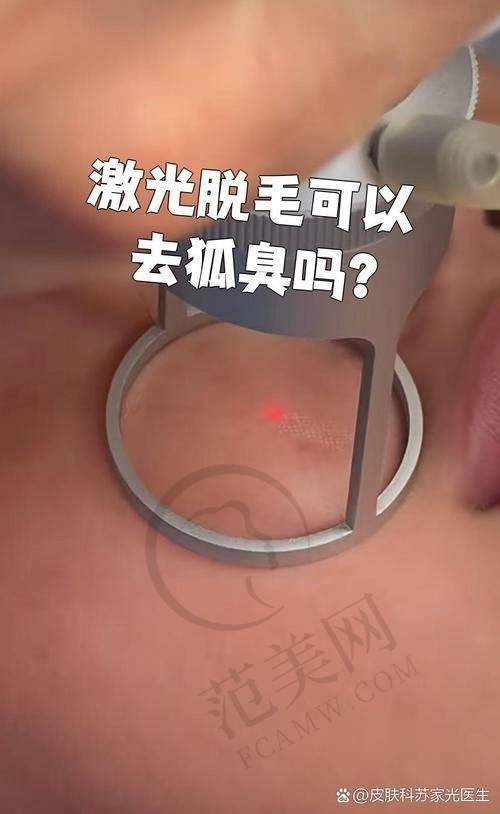 新疆医科大学第一附属医院整形科口碑好不好？附真实患者口碑评价