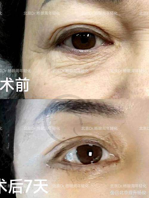 深圳出色丽格医疗美容诊所口碑好不好？附真实患者口碑评价