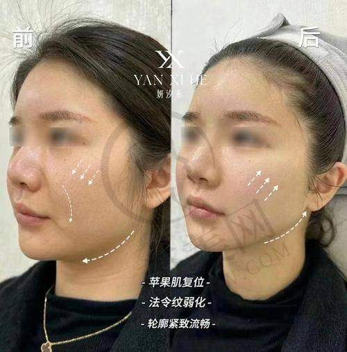 淮安丽格医疗美容门诊部项目特色