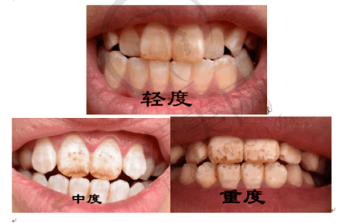 上海曙康口腔门诊部的矫正技术亮点