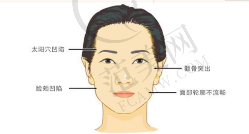 上海富华医疗美容医院怎么样，口碑评价如何？