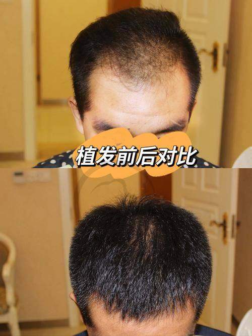 西安健丽医美医院怎么样，口碑评价如何？