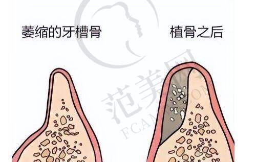 西安下面修复手术做得好的医院就诊指南