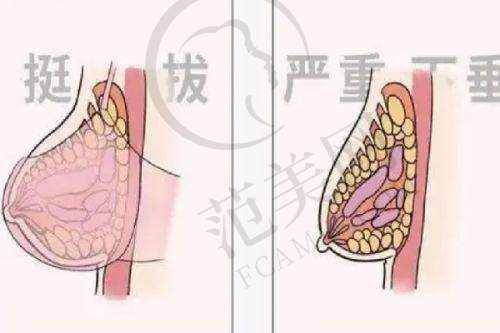 叶飞医生擅长的整形项目