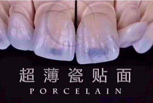 资阳做正畸排名靠前的口腔之资阳市中医医院口腔科