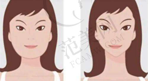 深圳美诗沁港丹医疗美容怎么样？眼部整形优势突显