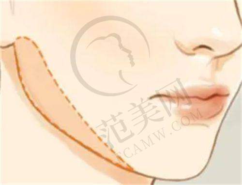深圳正规十大整形医院排名榜之深圳曹孟君医疗美容门诊部
