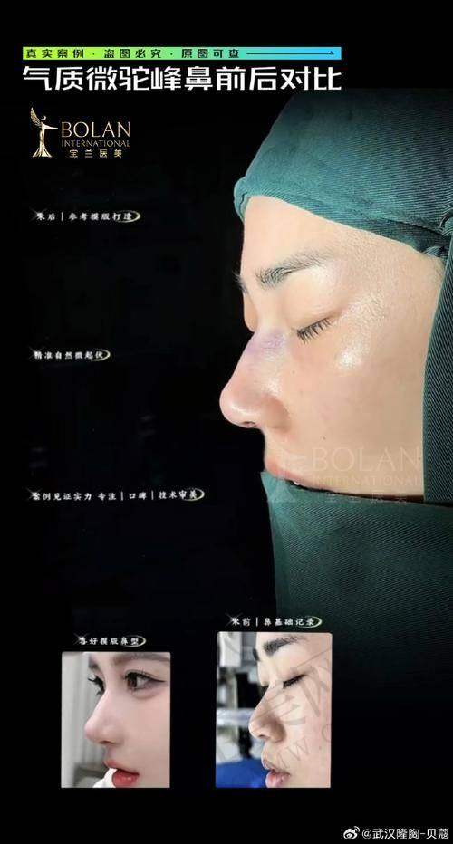 叶飞医生的口碑评价反馈