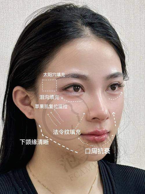 莆田海峡医疗美容医院项目特色