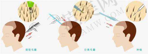 郑州碧莲盛植发医院基本信息