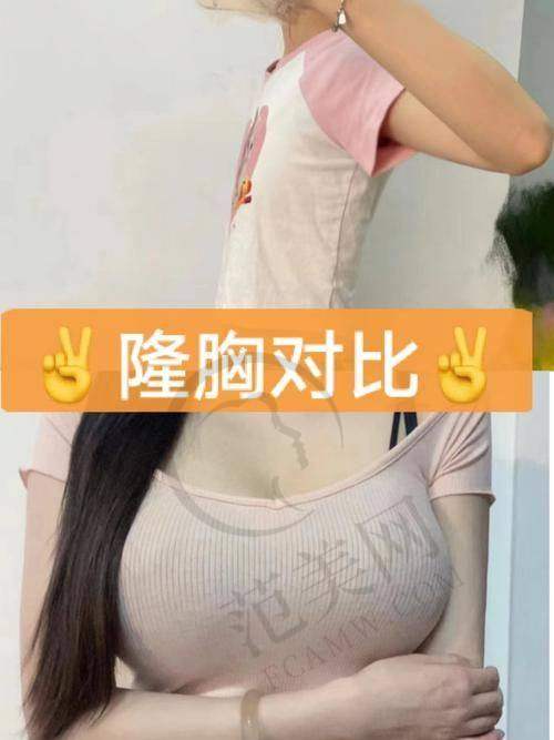 倪形斌医生坐诊的宁波摩范植发门诊部