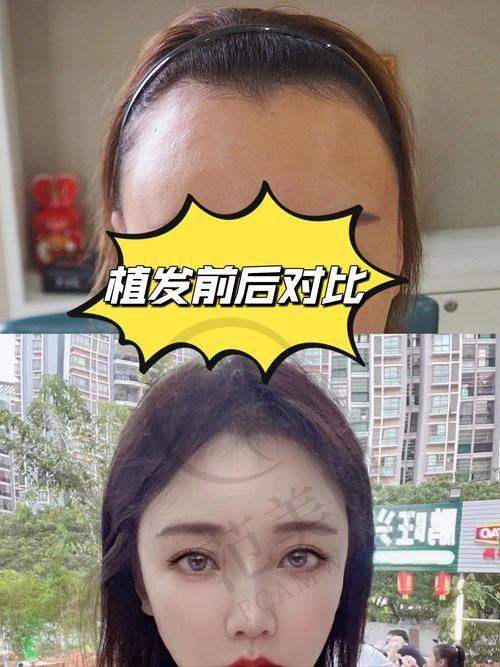 李美瑛医生坐诊的北京熙朵植发门诊部