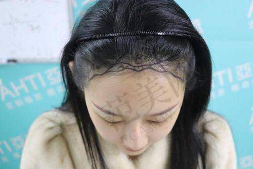 李美瑛医生的个人资料与优势