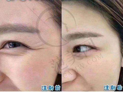 鼻整形选文丰亲测无痕妈生鼻：医院地址和预约诀窍