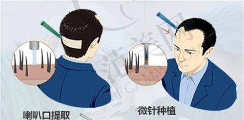 北京瑞丽诗植发医院医生简介